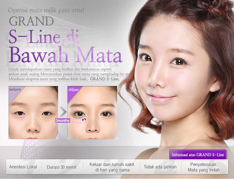 S-Line di Bawah Mata